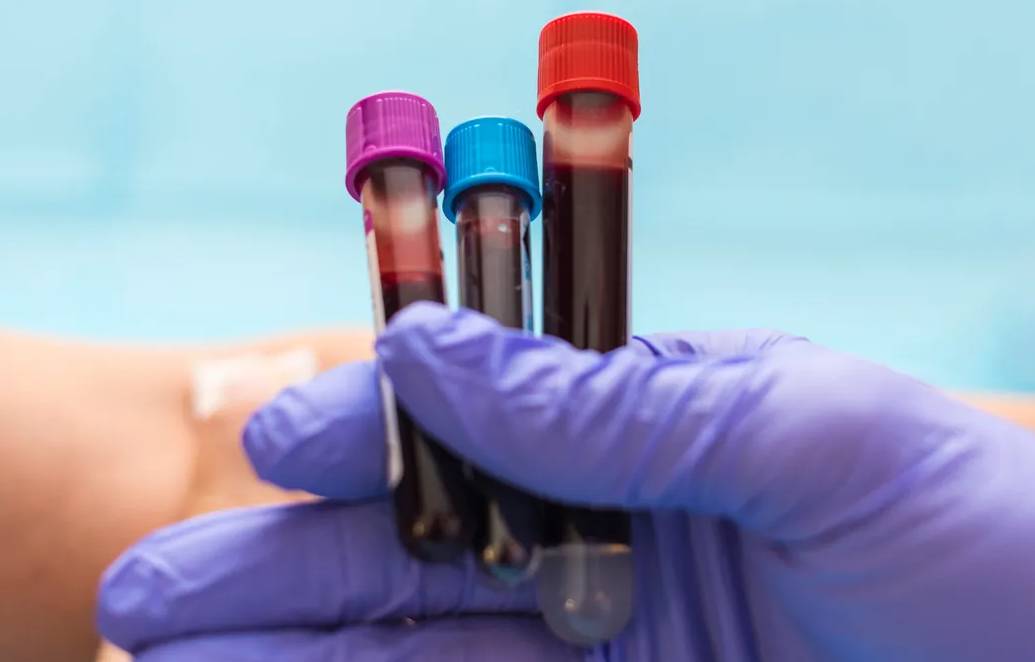 Что показывает анализ коагулограммы