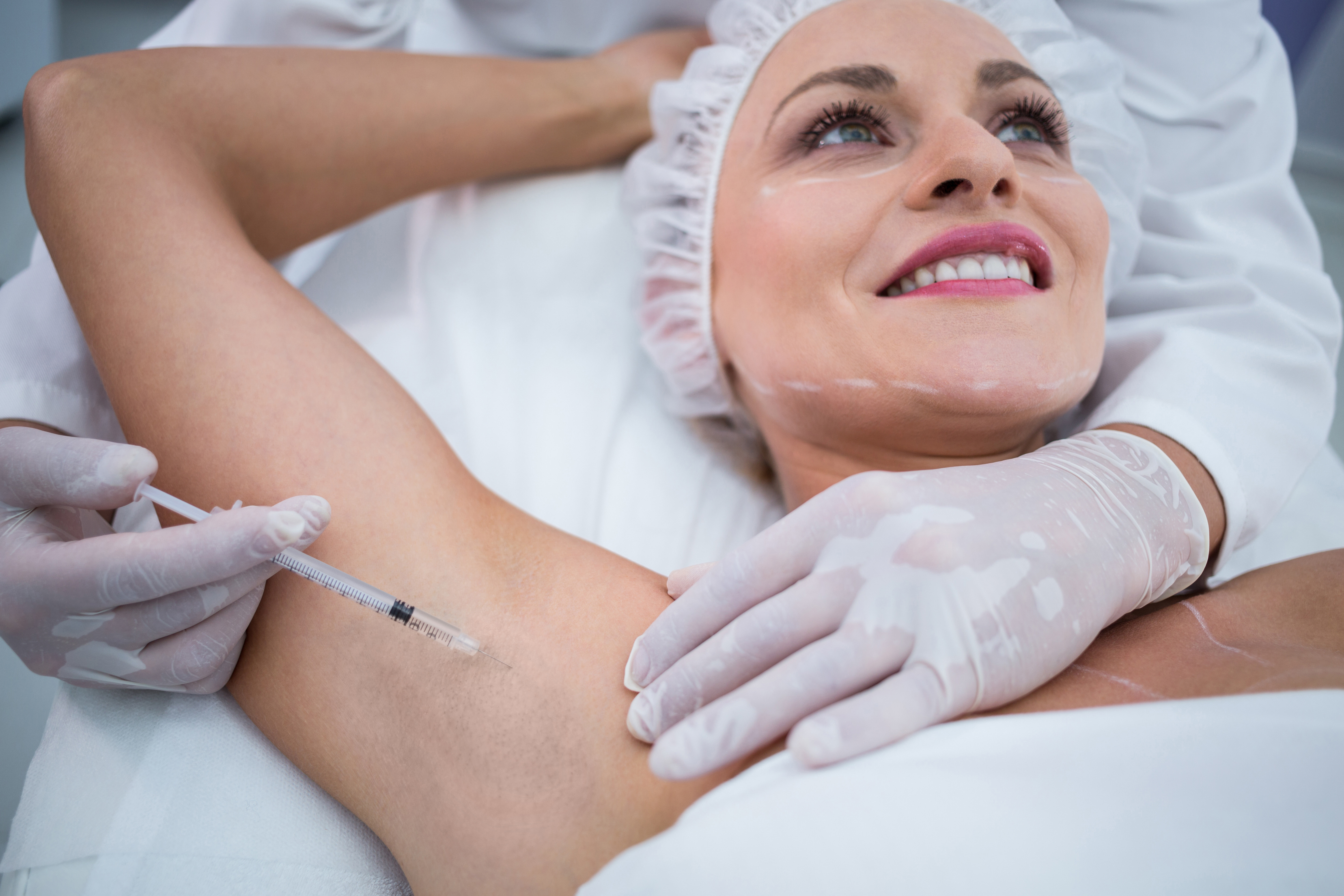 Коррекция гипергидроза в MYBEAUTY